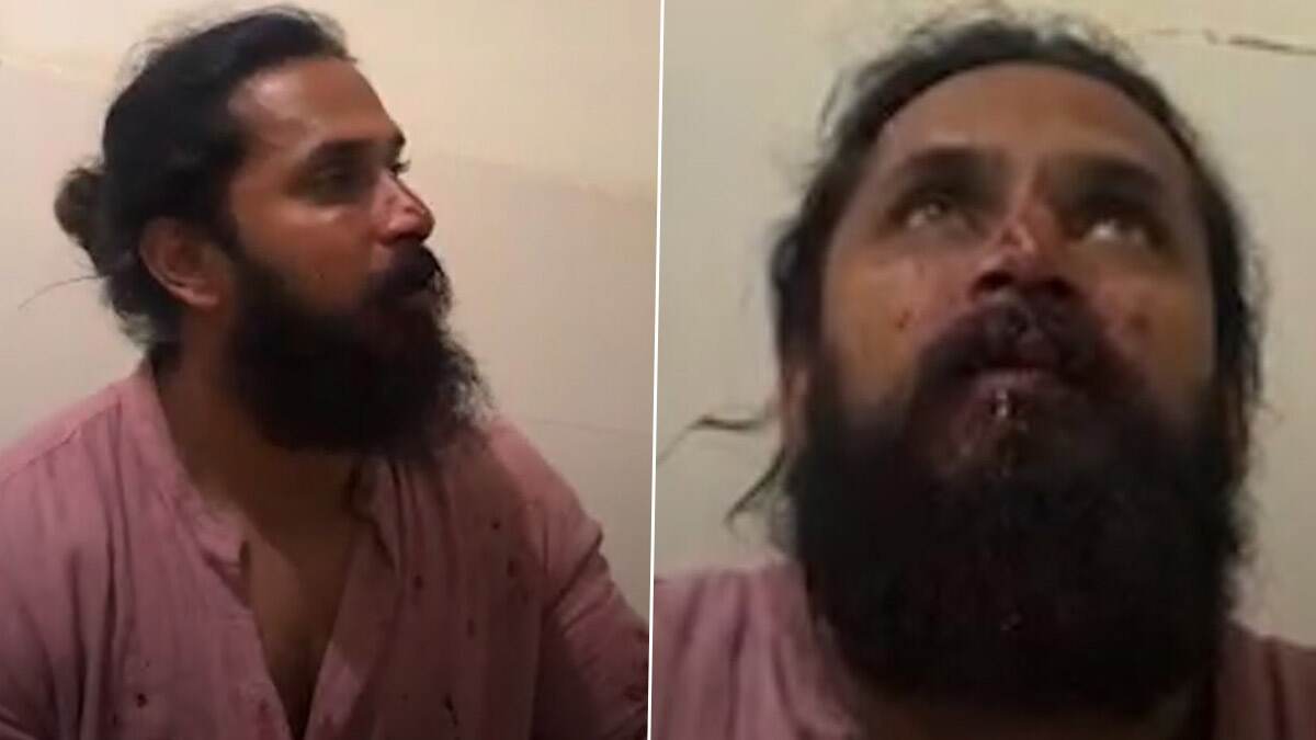 Chetan Chanddrra Attacked: முகமெல்லாம் இரத்த காயம்... 20 பேர் கும்பலால் அடித்து நொறுக்கப்பட்ட பிரபல நடிகர் சேட்டன் சந்திரா.. பதறவைக்கும் விளக்கம்.!