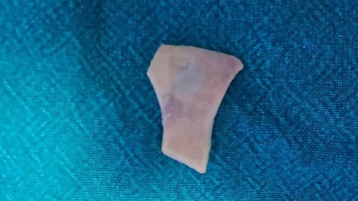 Mutton Bone Removed from Esophagus: 66 வயது முதியவரின் உணவுக்குழாயில் சிக்கிய 3.5 செ.மீ அளவிலான எலும்புத்துண்டு; உயிர்காத்த மருத்துவர்கள்.!