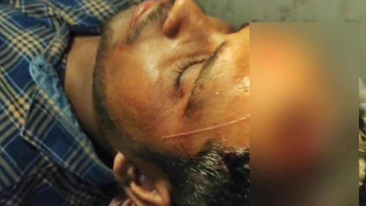 BJP TMC Clash in WB: பாஜக - திரிணாமுல் காங்கிரஸ் தொண்டர்கள் மோதல்; செய்தியாளரின் மண்டை உடைப்பு.!