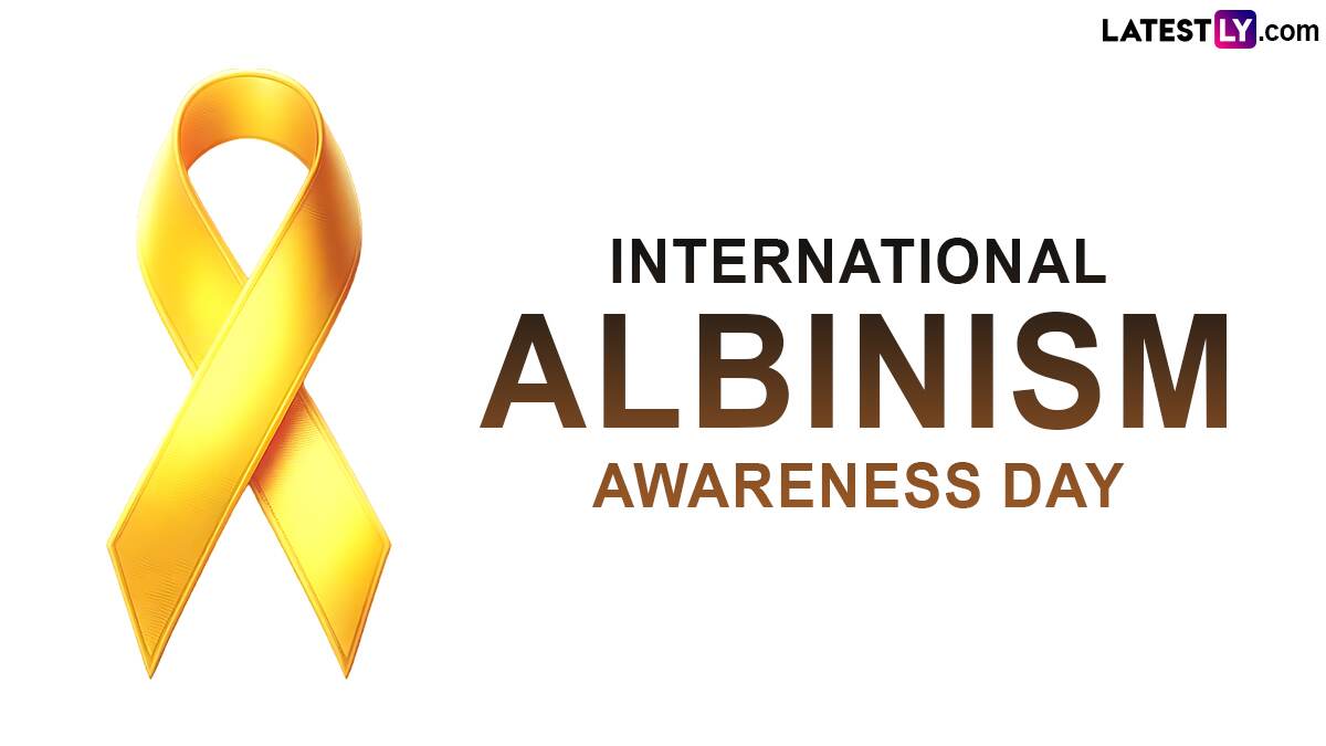 International Albinism Awareness Day 2024: சர்வதேச அல்பினிசம் விழிப்புணர்வு தினம்.. இது தொற்றுநோயா? இதிலிருந்து விடுபடுவது எப்படி?.!