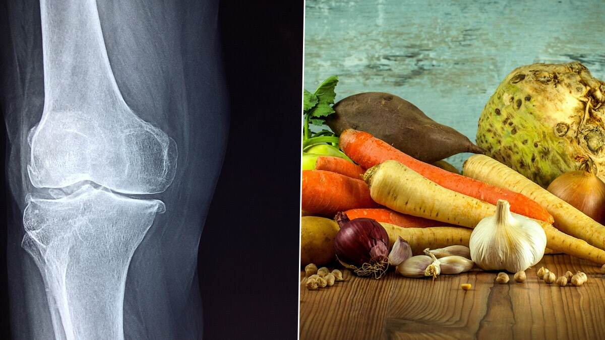 Bone Health: எலும்பு ஆரோக்கியத்தை மேம்படுத்த உதவும் உணவு முறைகள்..!