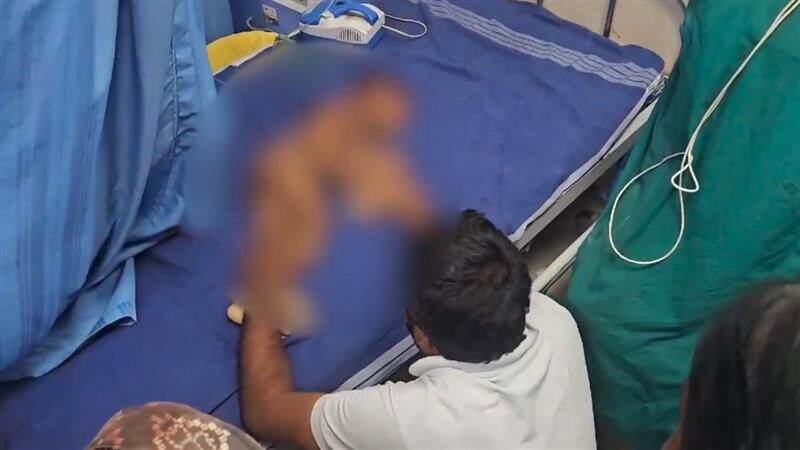 Boy Dies of Dog Bite: நாய் கடித்து 2 வயது சிறுவன் உயிரிழந்த சோகம்.. பதைபதைக்க வைக்கும் வீடியோ வைரல்..!