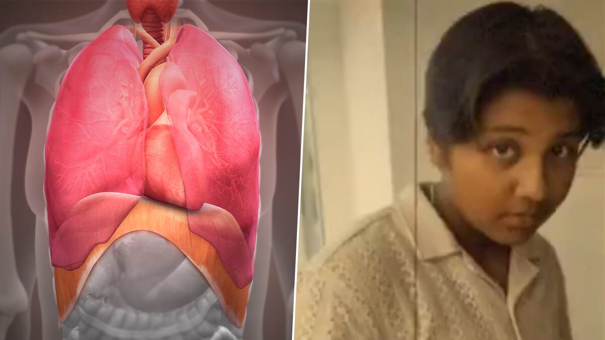 Diaphragm Failure: நுரையீரல் தசை கிழிந்து சிறுமி உயிரிழப்பு.. மருத்துவர்கள் கூறுவது என்ன?.. மக்களே கவனம்.!