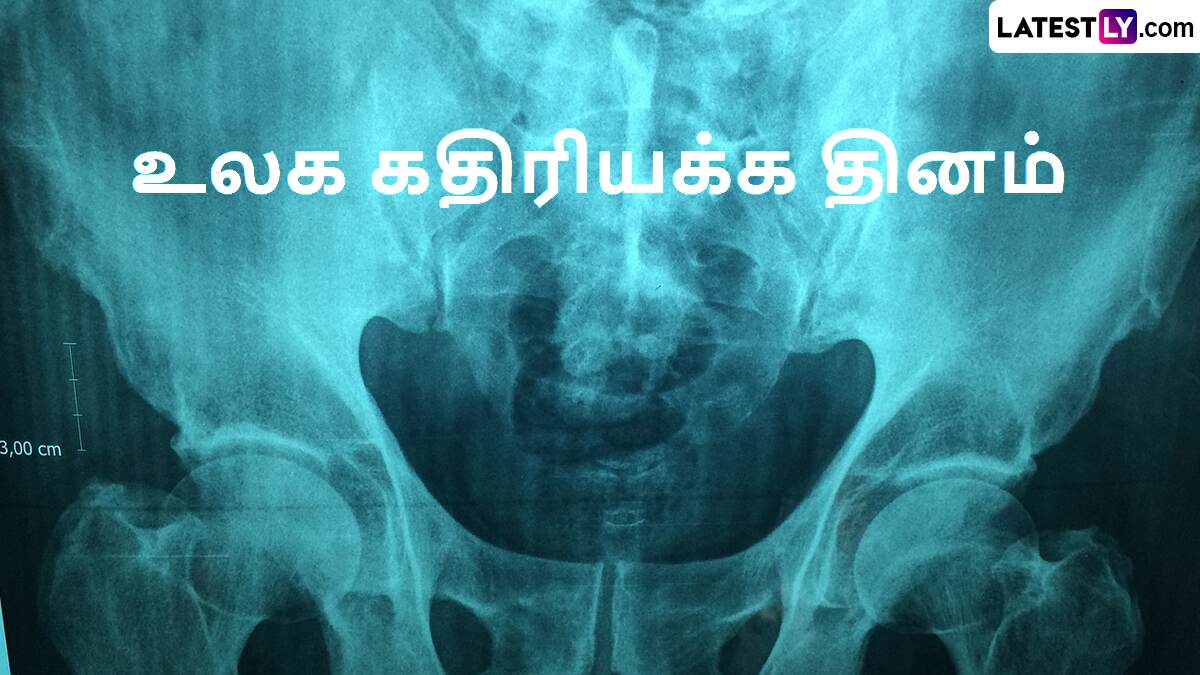 World Radiography Day 2024: உலக கதிரியக்க தினம்.. வரலாறு என்ன தெரியுமா?!
