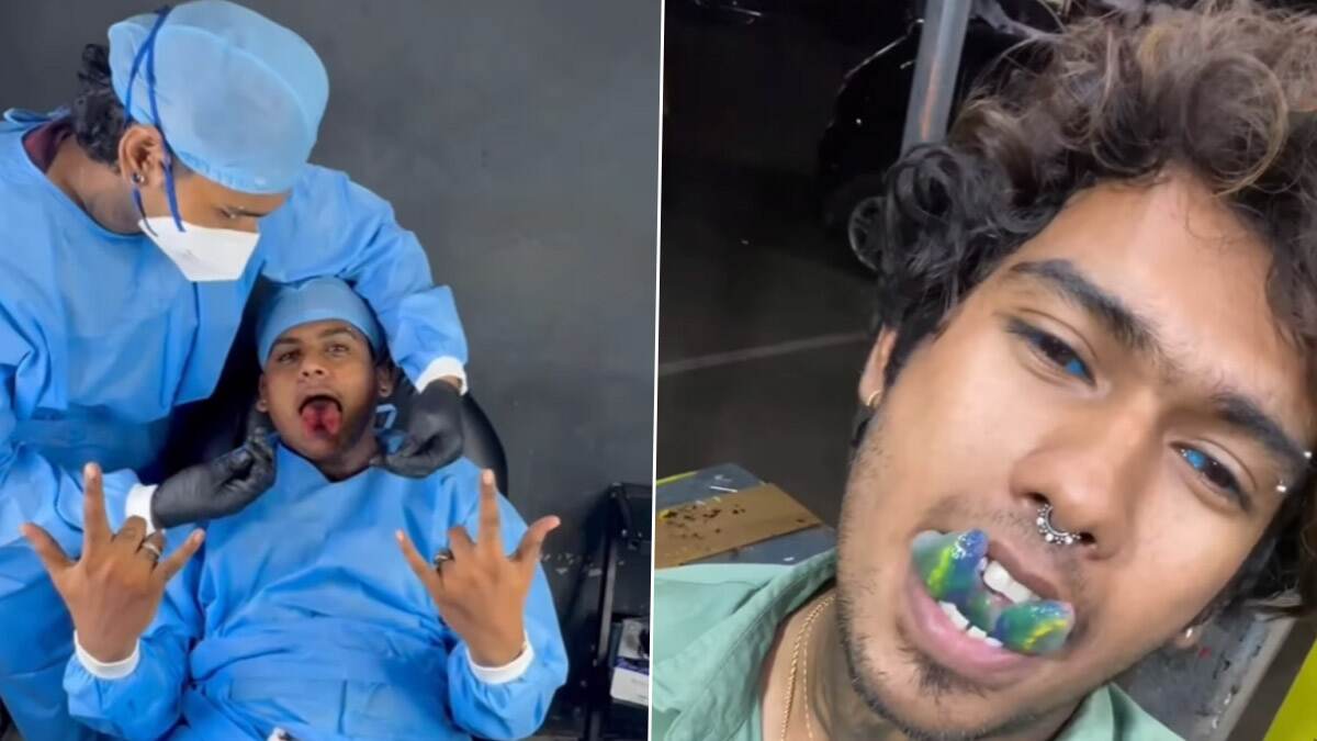 Alien EMO Tattoo: நாக்கை அறுத்து, கண்களில் ஊசி செலுத்தி நிறம் பூசும் டாட்டூ; விசமத்தனமான செயலை மேற்கொண்ட 2 இளைஞர்கள் கைது.!