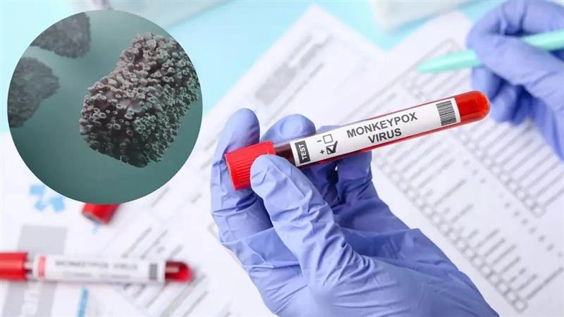Monkeypox Virus: இந்தியாவில் மீண்டும் நுழைந்தது எம்பாக்ஸ் வைரஸ்; 40 வயது நபருக்கு உறுதி..!