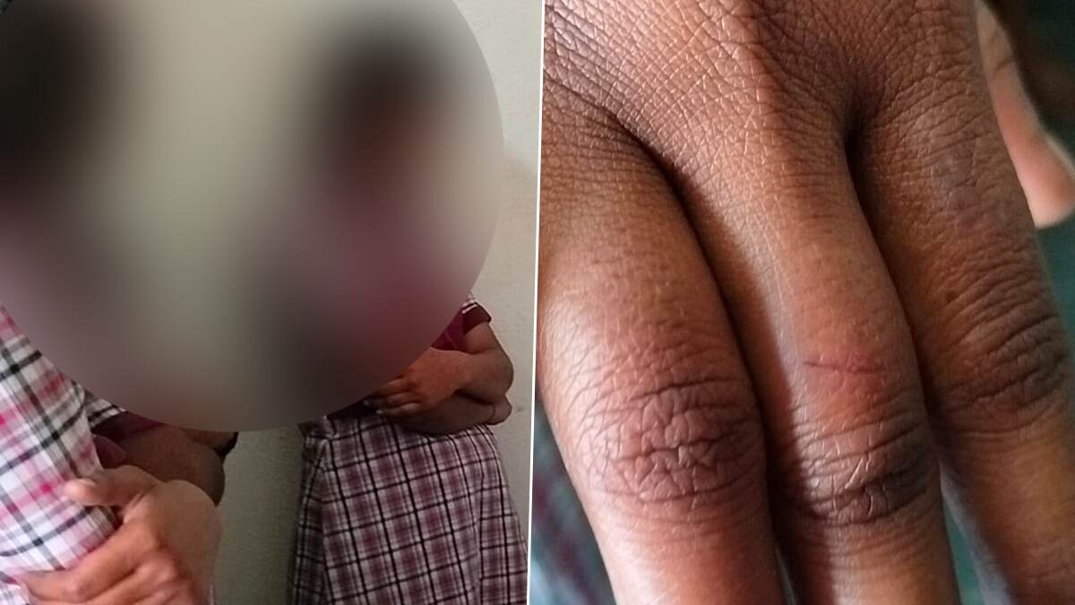 Teacher Beats Students: கண்மூடித்தனமாக தாக்கும் ஆசிரியர்.. காயத்துடன் பள்ளி மாணவிகள்..!