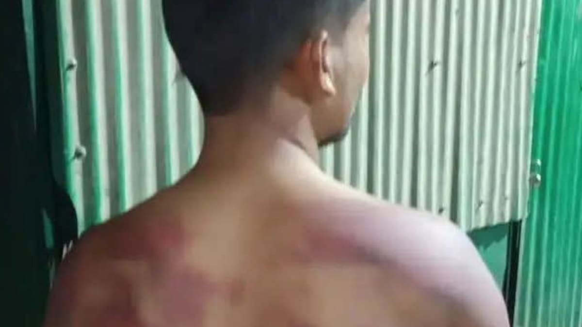 வாலிபரை நிர்வாணமாக்கி, கட்டி வைத்து கொடூர தாக்குதல்.. காதலி குடும்பத்தினர் வெறிச்செயல்..!