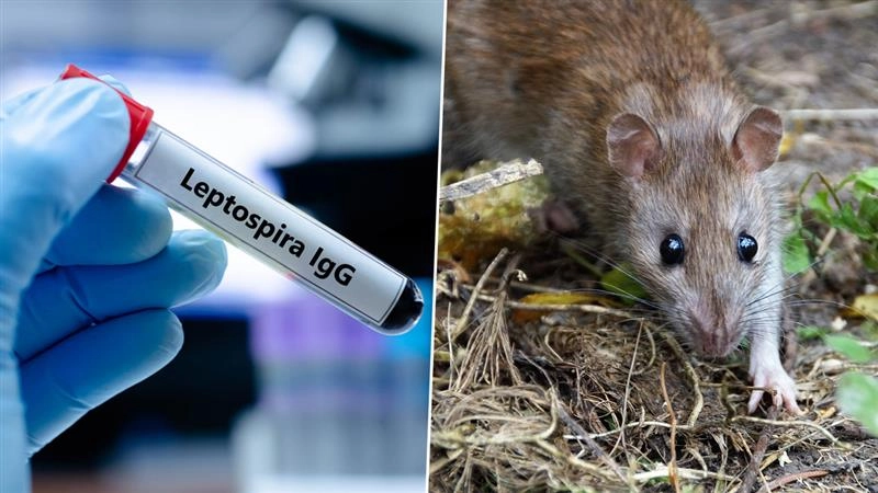 Rat Fever: நெல்லையில் எலிக்காய்ச்சல் பரவல்.. தனியார் கல்லூரி மாணவர்கள் பாதிப்பு.. அறிகுறியும், தடுப்பு முறைகளும்.!