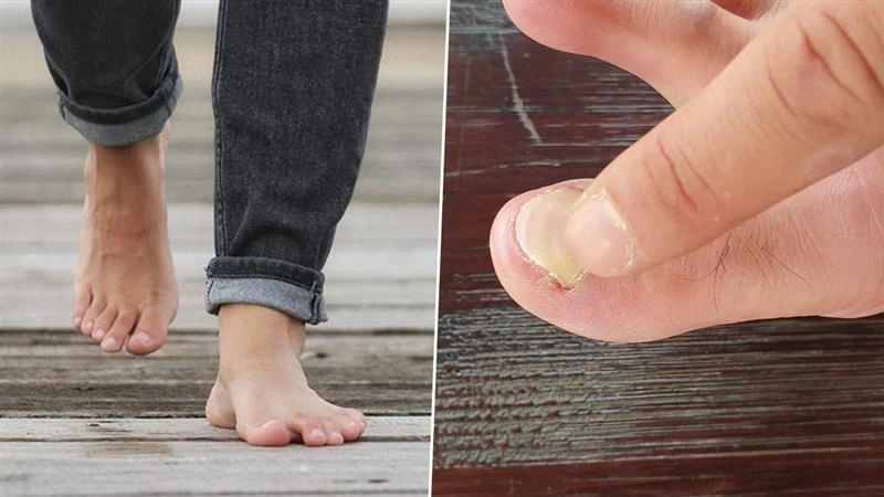 Foot Infection: மழைக்காலத்தில் உஷார்.. காலில் தோன்றும் வெள்ளை நிற பூஞ்சை தொற்று.. கவனிக்க வேண்டியவை.!
