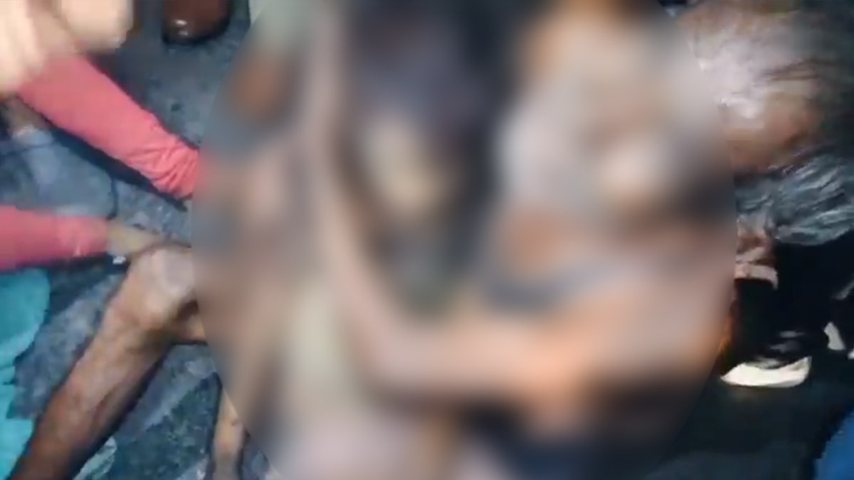 Dog Attack: நடைபாதையில் உறங்கிய 5 வயதுடைய சிறுமி நாய் கடித்து பலி., ஒன்றரை வயது குழந்தை உயிர் ஊசல்.. நெஞ்சை பதறவைக்கும் சோகம்.!